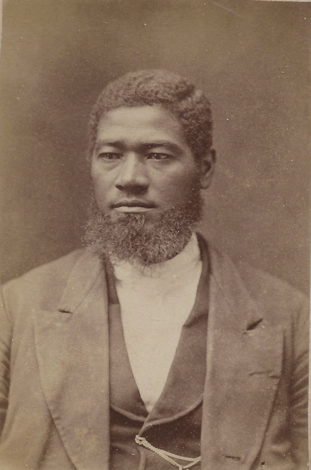 Allen, Black Professor